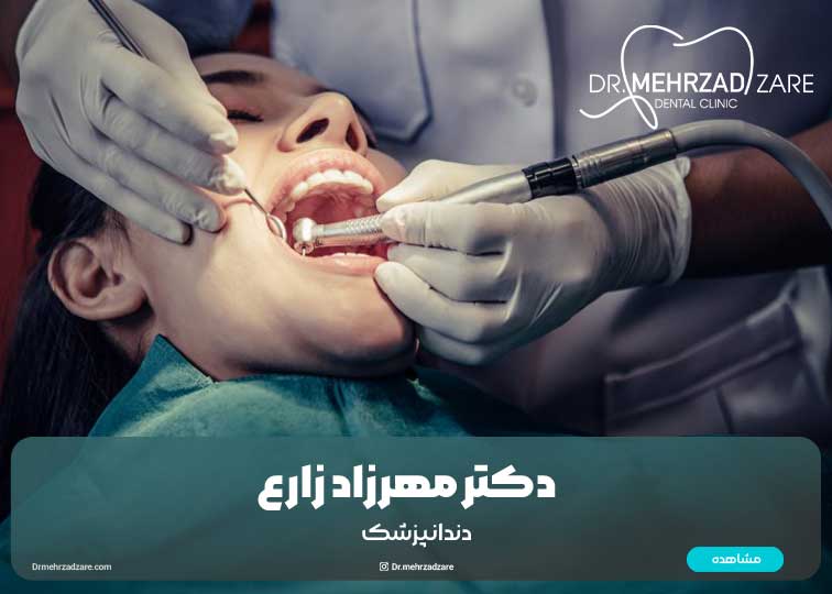انواع جراحی‌های دندان عقل